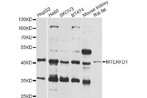 Western blot analysis of extracts of various cell lines, using MTERFD1 antibody (ABIN6293949) at 1:1000 dilution. (MTERFD1 antibody)
