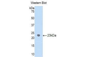 Western Blotting (WB) image for anti-gamma Glutamyltransferase 1 (GGT1) (AA 122-299) antibody (ABIN1859003) (GGT1 antibody  (AA 122-299))