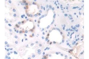 Detection of TAF1 in Human Kidney Tissue using Polyclonal Antibody to TATA Box Binding Protein Associated Factor 1 (TAF1) (TAF1 antibody  (AA 1379-1636))