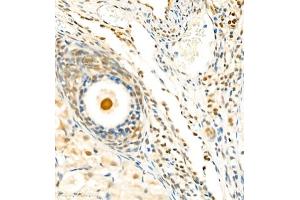 Immunohistochemistry of paraffin embedded mouse ovary using Skar (ABIN7074970) at dilution of 1:1800 (400x lens) (p46 antibody)