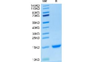 CCL2 Protein (AA 24-99) (His tag)