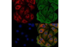 ABIN6259741 and ABIN6279518 staining Hela cells by IF/ICC. (Acsl3 antibody  (Internal Region))