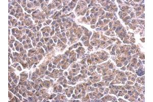 IHC-P Image Cytochrome C1 antibody detects CYC1 protein at cytosol on BT483 xenograft by immunohistochemical analysis. (Cytochrome C1 antibody)