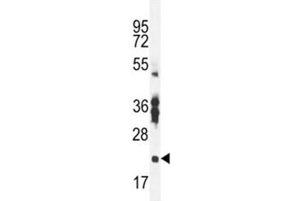 RBPMS2 antibody  (AA 113-141)