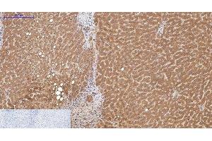 Immunohistochemistry of paraffin-embedded Human liver tissue using COL3A1 Monoclonal Antibody at dilution of 1:200. (COL3A1 antibody)
