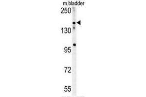 CASZ1 Antibody (C-term) western blot analysis in mouse bladder tissue lysates (15µg/lane). (CASZ1 antibody  (C-Term))