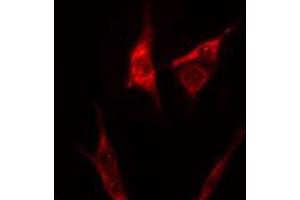 ABIN6275263 staining 293 cells by IF/ICC. (Myosin antibody  (Internal Region))