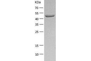 CPE Protein (AA 43-476) (His tag)