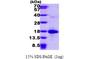 SDS-PAGE (SDS) image for LSM4 Homolog, U6 Small Nuclear RNA Associated (LSM4) (AA 1-139) protein (His tag) (ABIN667317)