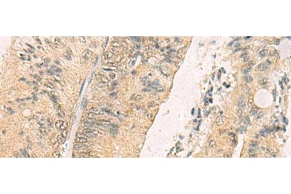 THG1L antibody