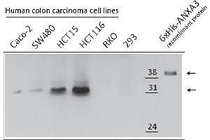 Western Blotting (WB) image for anti-Annexin A3 (ANXA3) antibody (ABIN2703592) (Annexin A3 antibody)