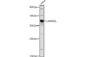 Western blot analysis of extracts of HeLa cells, using LML antibody (ABIN7268204) at 1:1000 dilution.