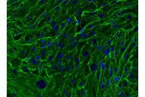 Immunofluorescent analysis of Fibronectin in mesenchymal stem cells (MSC). (Fibronectin antibody)