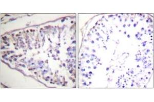 Immunohistochemistry analysis of paraffin-embedded human tonsil tissue, using HSL (Ab-552) Antibody. (LIPE antibody  (AA 518-567))