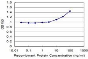 Detection limit for recombinant GST tagged SQSTM1 is approximately 3ng/ml as a capture antibody. (SQSTM1 antibody  (AA 1-440))