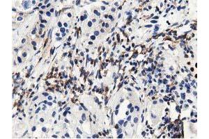 Immunohistochemical staining of paraffin-embedded Human prostate tissue using anti-MICAL1 mouse monoclonal antibody.