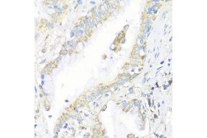 Immunohistochemistry of paraffin-embedded human lung using EIF3J antibody.