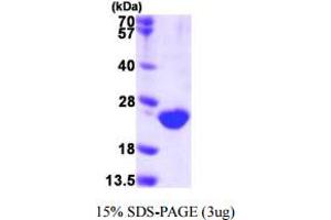 SDS-PAGE (SDS) image for Dual Specificity Phosphatase 3 (DUSP3) (AA 1-185) protein (His tag) (ABIN667577) (Dual Specificity Phosphatase 3 (DUSP3) (AA 1-185) protein (His tag))