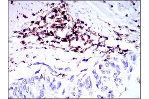 Immunohistochemistry (IHC) image for anti-Protein tyrosine Phosphatase, Receptor Type, C (PTPRC) (AA 928-989) antibody (ABIN1724924)