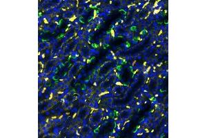 IF analysis of SLC4A1 using anti-SLC4A1 antibody (ABIN3043930) SLC4A1 was detected in paraffin-embedded section of rat kidney tissues. (Band 3/AE1 antibody  (AA 28-365))