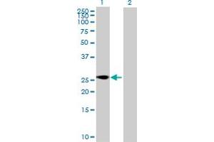 Western Blot analysis of SFRS9 expression in transfected 293T cell line by SFRS9 MaxPab polyclonal antibody. (SFRS9 antibody  (AA 1-221))