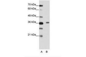 Image no. 2 for anti-BTB (POZ) Domain Containing 6 (BTBD6) (AA 87-136) antibody (ABIN202456) (BTBD6 antibody  (AA 87-136))