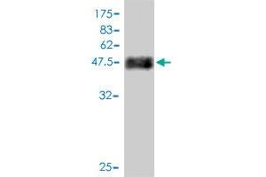 Western Blot detection against Immunogen (47. (Transgelin 3 antibody  (AA 1-199))