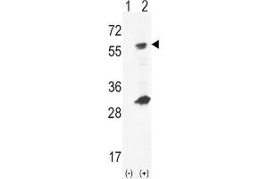 Western Blotting (WB) image for anti-Glucokinase (Hexokinase 4) (GCK) antibody (ABIN5023820) (GCK antibody)