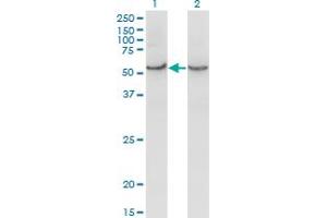 Western Blot analysis of COX15 expression in transfected 293T cell line by COX15 monoclonal antibody (M01), clone 2D2.