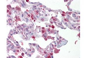 Anti-FOSL1 / FRA1 antibody IHC of human lung. (FOSL1 antibody  (AA 143-192))