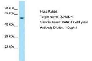 Image no. 1 for anti-D-2-Hydroxyglutarate Dehydrogenase (D2HGDH) (AA 332-381) antibody (ABIN6750028) (D2HGDH antibody  (AA 332-381))