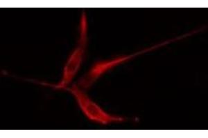 ABIN6275362 staining HeLa cells by IF/ICC. (Plakophilin 2 antibody  (N-Term))