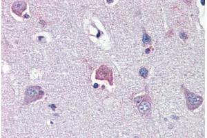 Human Brain, Cortex (formalin-fixed, paraffin-embedded) stained with LDOC1 antibody ABIN462213 followed by biotinylated goat anti-rabbit IgG secondary antibody ABIN481713, alkaline phosphatase-streptavidin and chromogen. (LDOC1 antibody  (N-Term))