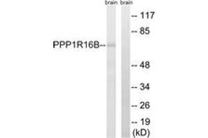 Western blot analysis of extracts from mouse brain cells, using PPP1R16B Antibody. (PPP1R16B antibody  (AA 364-413))