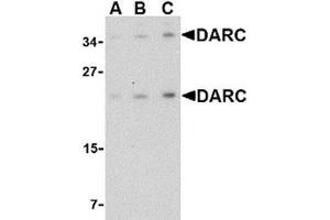 Western blot analysis of DARC in mouse brain tissue lysate with AP30273PU-N DARC antibody at (A) 0. (DARC antibody  (C-Term))
