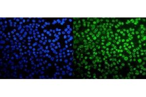 IF analysis of TAF4 using anti-TAF4 antibody (ABIN7602114).