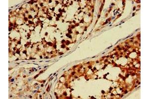 Immunohistochemistry of paraffin-embedded human testis tissue using ABIN7150681 at dilution of 1:100 (PDE11A antibody  (AA 42-190))