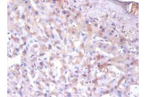 Immunohistochemistry of paraffin-embedded human liver tissue using ABIN7151681 at dilution of 1:100 (ERP29 antibody  (AA 40-251))