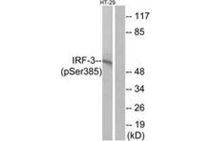 Western blot analysis of extracts from HT29 cells treated with INSULIN 0.