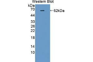 Western blot analysis of recombinant Human IK. (Protein Red (IK) (AA 1-192) antibody)