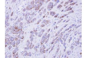 IHC-P Image Immunohistochemical analysis of paraffin-embedded MDAMB468 xenograft , using phospholipid scramblase 1, antibody at 1:500 dilution. (PLSCR1 antibody)