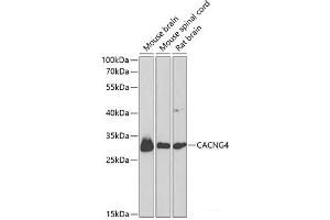 Western blot analysis of extracts of various cell lines using CACNG4 Polyclonal Antibody at dilution of 1:1000.