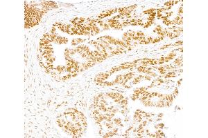 Immunohistochemistry (IHC) image for anti-SWI/SNF Related, Matrix Associated, Actin Dependent Regulator of Chromatin, Subfamily A, Member 2 (SMARCA2) (AA 100-150) antibody (ABIN7795711)