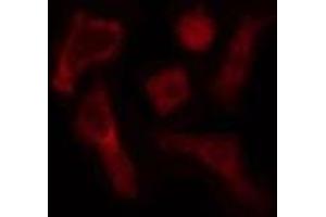 ABIN6275179 staining  HepG2 cells by IF/ICC. (GNB5 antibody  (Internal Region))