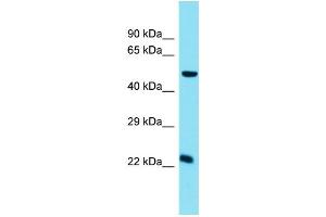 Host: Rabbit  Target Name: Chmp5  Sample Tissue: Mouse Small Intestine lysates  Antibody Dilution: 1. (CHMP5 antibody  (C-Term))