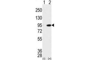 Western Blotting (WB) image for anti-Male Germ Cell-Associated Kinase (MAK) antibody (ABIN3003276) (MAK antibody)