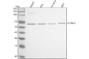 Western blot analysis of ACVR2A using anti-ACVR2A antibody (ABIN7600518).