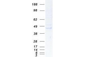 Western Blotting (WB) image for RAS (RAD and GEM)-Like GTP Binding 2 (REM2) protein (Myc-DYKDDDDK Tag) (ABIN2730710)