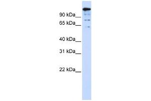 WB Suggested Anti-BACH2 Antibody Titration:  0. (BACH2 antibody  (Middle Region))