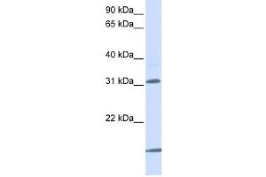 Western Blotting (WB) image for anti-Solute Carrier Family 25 (Mitochondrial Carrier, Oxoglutarate Carrier), Member 11 (SLC25A11) antibody (ABIN2458782) (SLC25A11 antibody)